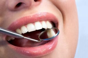 How Cosmetic Dentistry Can Transform Your Confidence