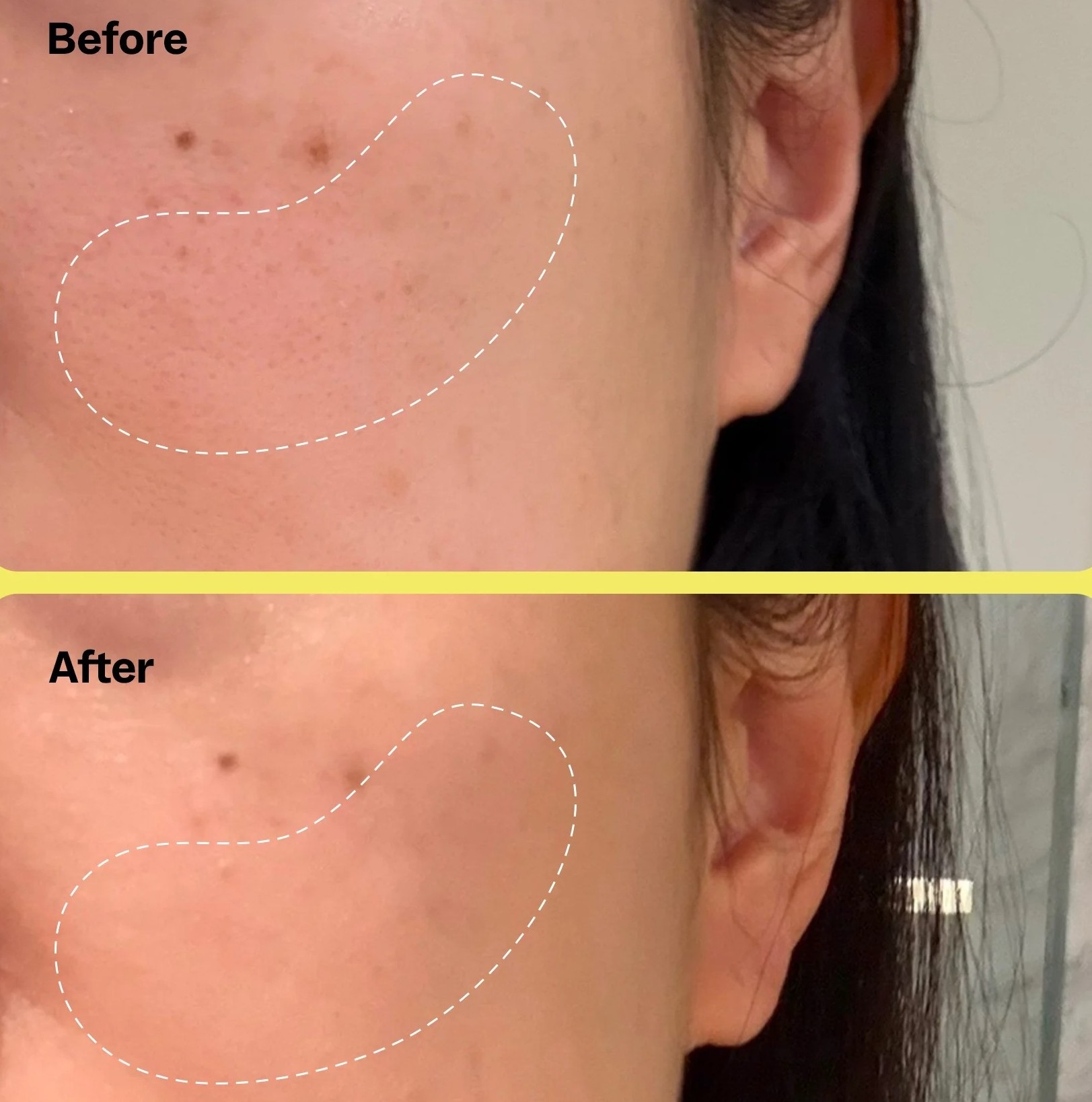 Fade Dark Spots w/ Peach Slices Super Fade Discoloration Serum