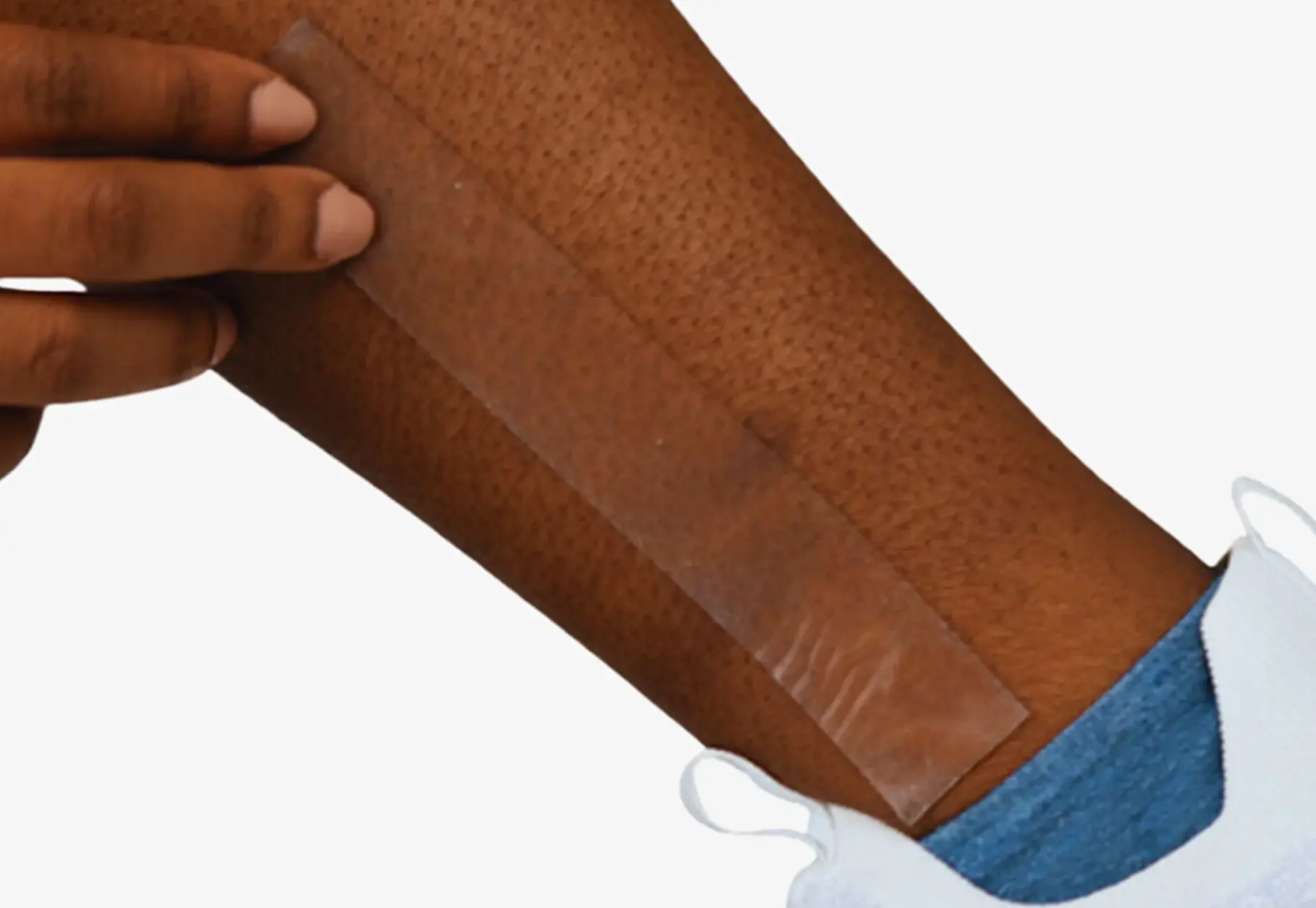 Not All Scars Are Created Equal - These Summer Solutions Work