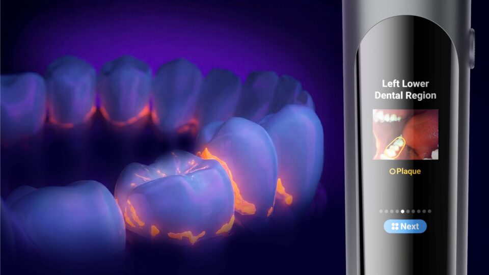 Can a Smart Toothbrush Detect Plaque? Meet the usmile D50 OralCam