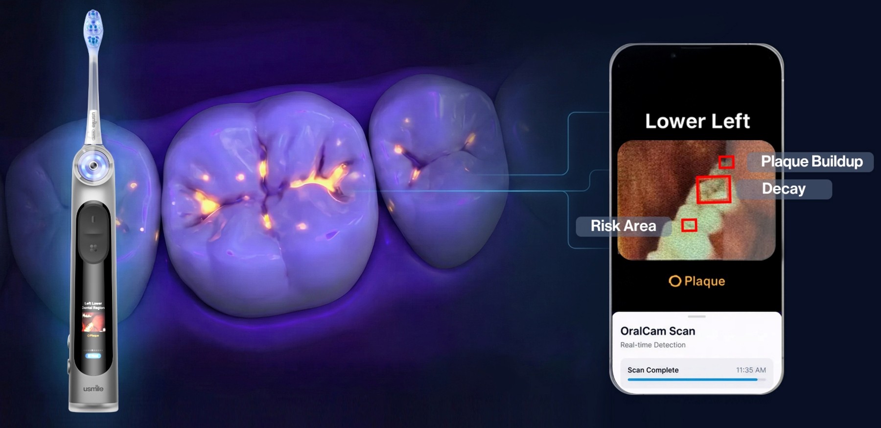 Can a Smart Toothbrush Detect Plaque? Meet the usmile D50 OralCam